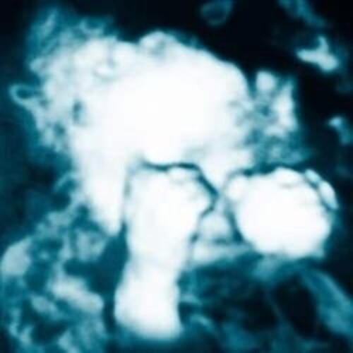 Sandra Monfort- Nino Reptil Angel [ VINYL LP ]