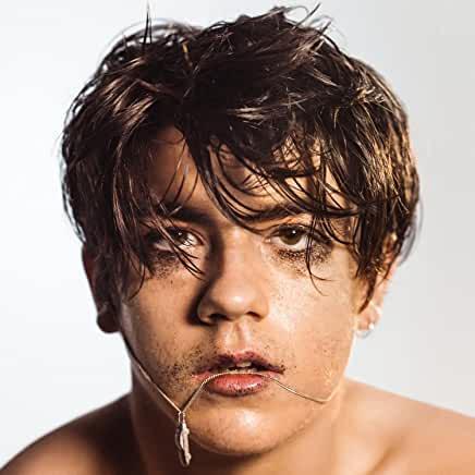 Declan McKenna- What Do You Think About The Car? (Clear/Yellow Vinyl) [ VINYL LP ]